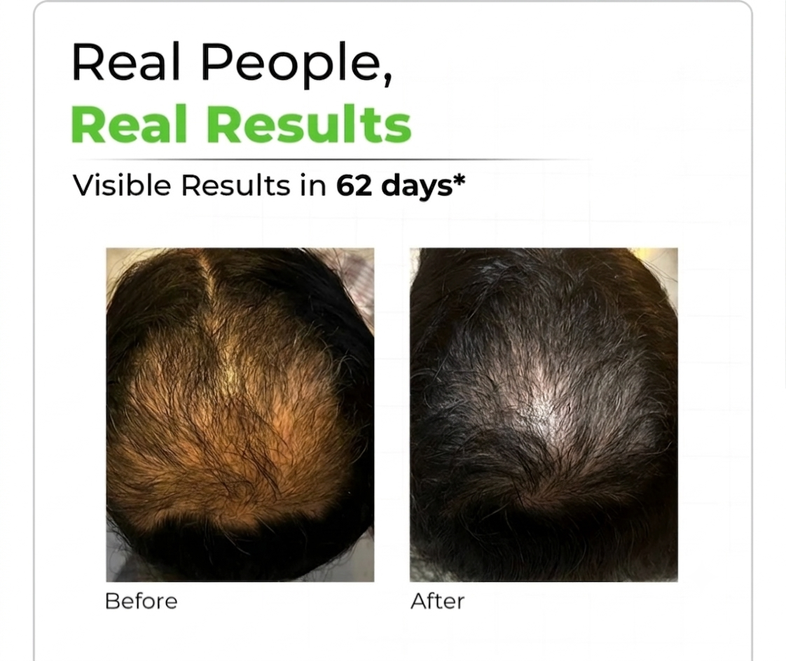 AarogyaTalkies Natural Herbal Hair Oil — product photo 4 of 8